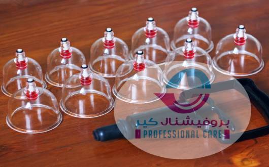 مركز حجامة في الكويت للرجال والنساء